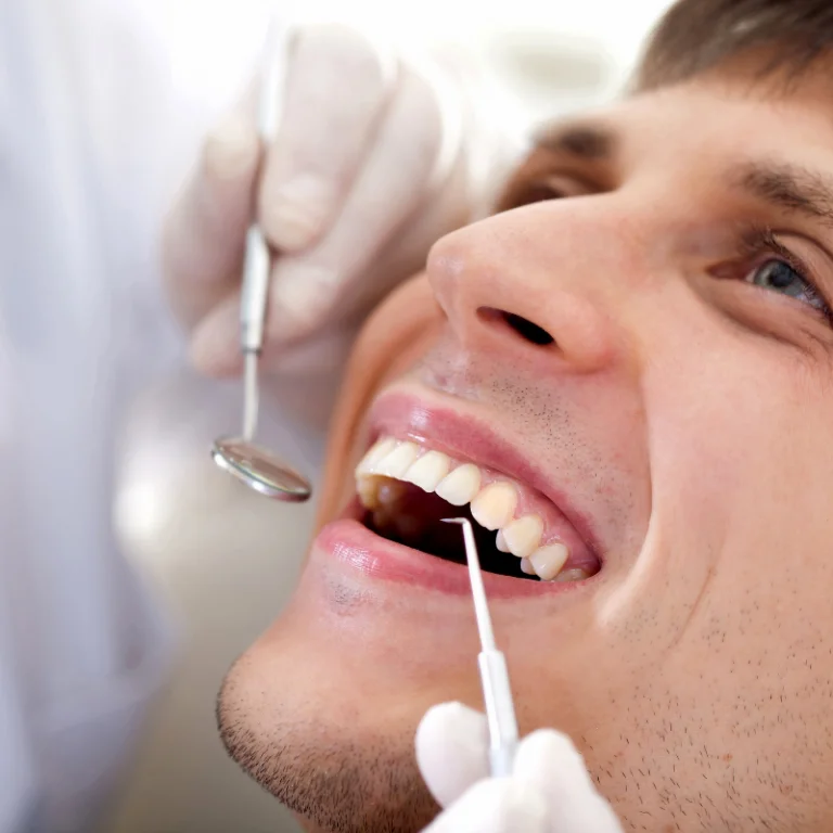 Dental Bonding 