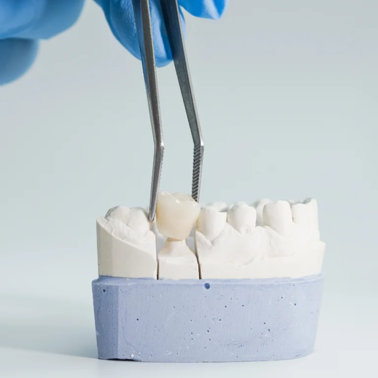Dental Crowns 