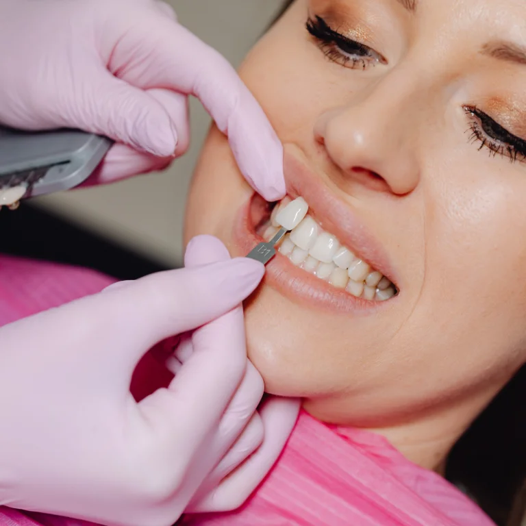 Porcelain Veneers 